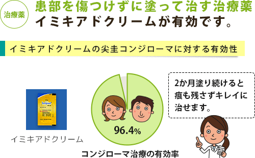 尖圭コンジローマがよくわかる疾患ガイドページ 薬の通販オンライン