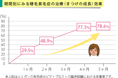 ルミガンの効果 いつから伸びる まつげの成長経過 について 薬の通販オンライン